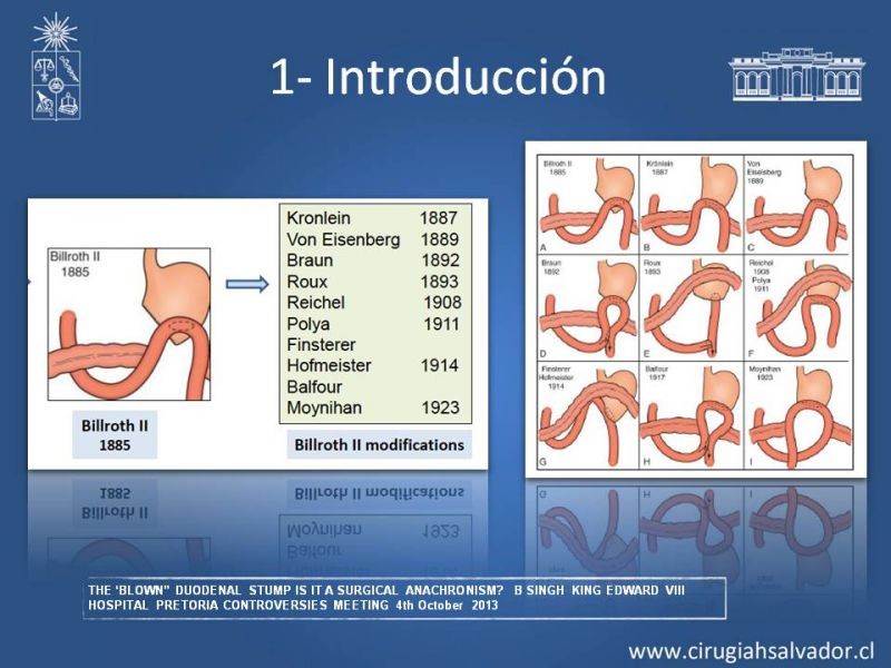 Diapositiva 3 de Manejo del muñón duodenal difícil
