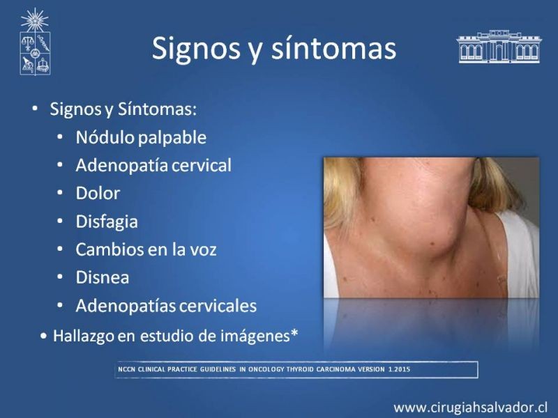 Diapositiva 8 de Cáncer Diferenciado de Tiroides