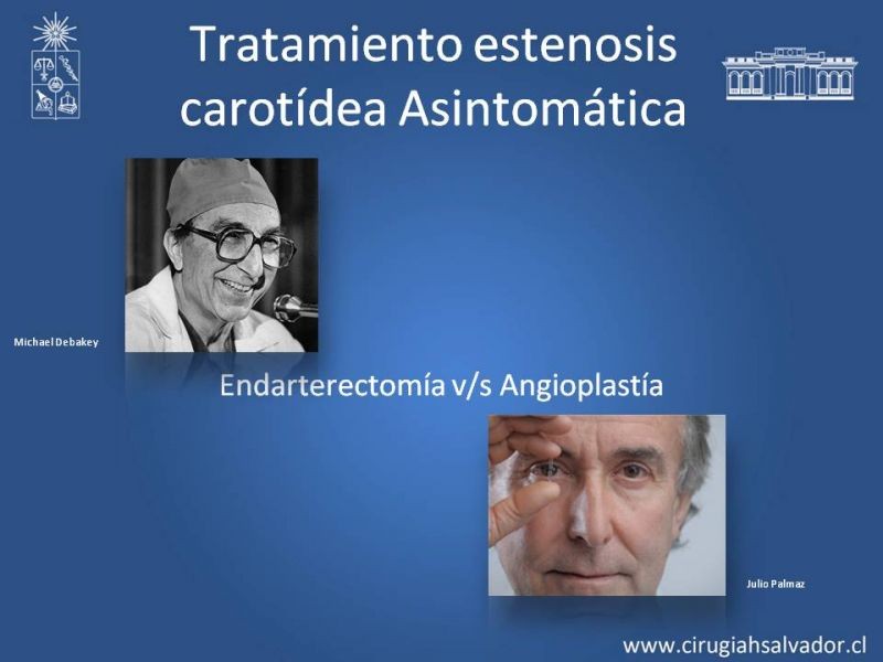 Diapositiva 28 de Estenosis Carotídea Asintomática