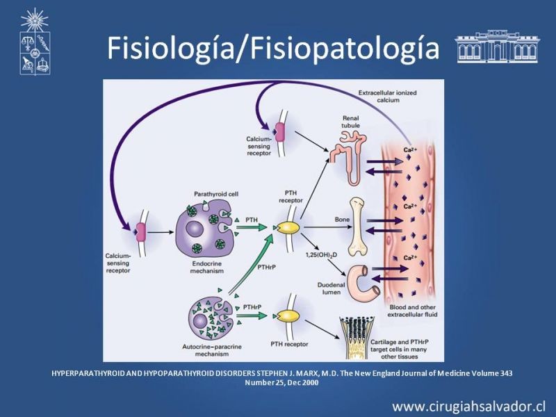 Diapositiva 4 de Hiperparatiroidismo secundario