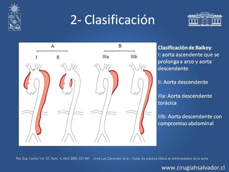 Diapositiva 9 de Síndrome Aórtico Agudo
