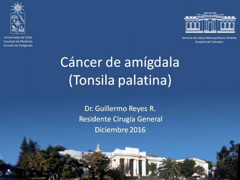 Diapositiva 25 de Cáncer de amígdala (Tonsila palatina)