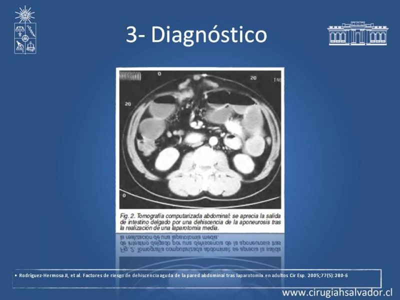 Diapositiva 13 de Manejo de la Evisceración