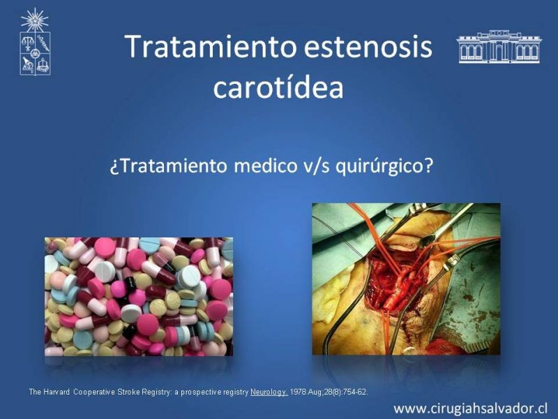 Diapositiva 21 de Estenosis Carotídea Asintomática