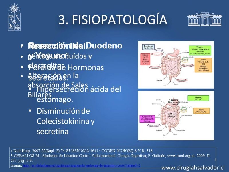 Diapositiva 7 de Sindrome intestino corto