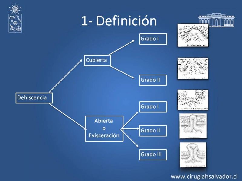 Diapositiva 9 de Manejo de la Evisceración