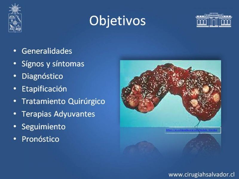Diapositiva 1 de Cáncer Diferenciado de Tiroides