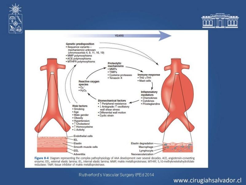 Diapositiva 10 de Aneurismas Periféricos