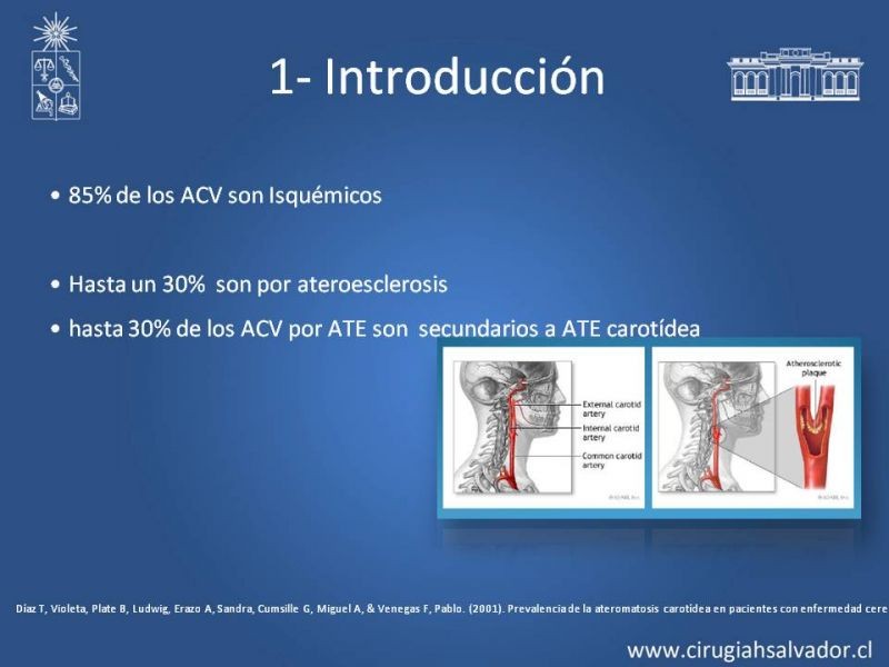 Diapositiva 3 de Estenosis Carotídea Asintomática