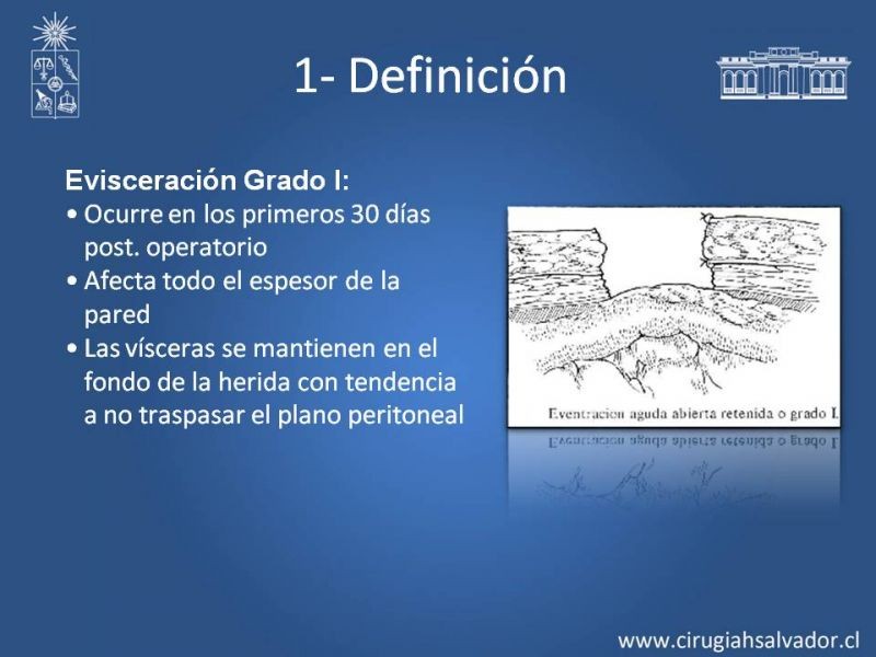 Diapositiva 6 de Manejo de la Evisceración