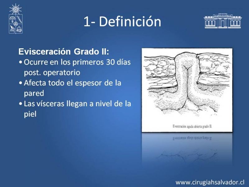Diapositiva 7 de Manejo de la Evisceración