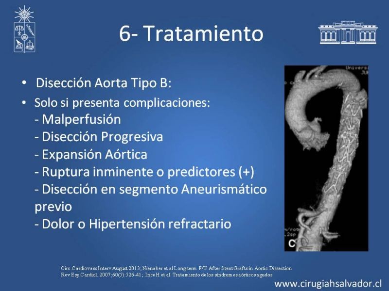 Diapositiva 31 de Síndrome Aórtico Agudo