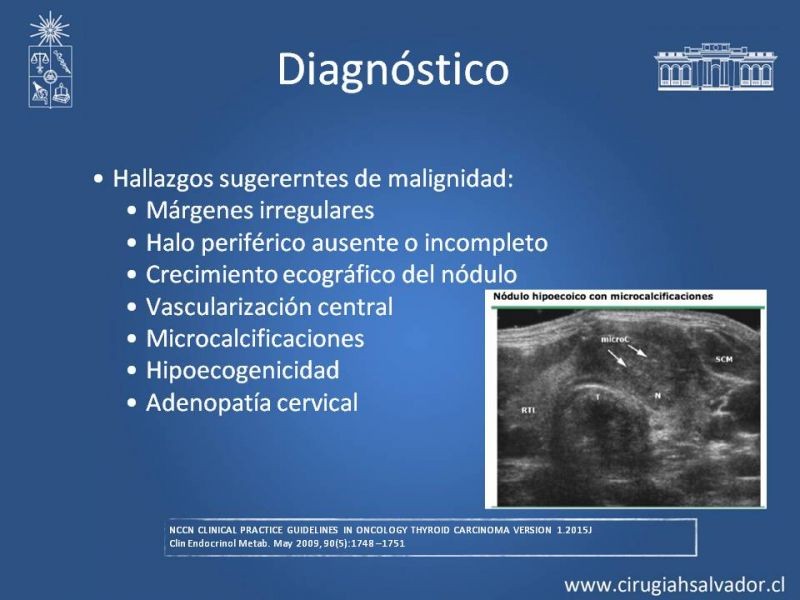 Diapositiva 11 de Cáncer Diferenciado de Tiroides