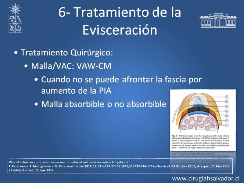 Diapositiva 29 de Manejo de la Evisceración