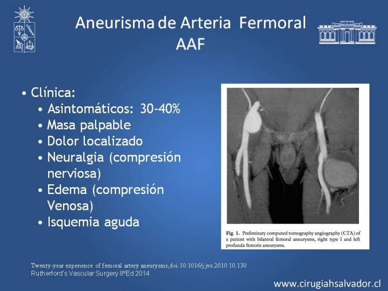 Diapositiva 25 de Aneurismas Periféricos