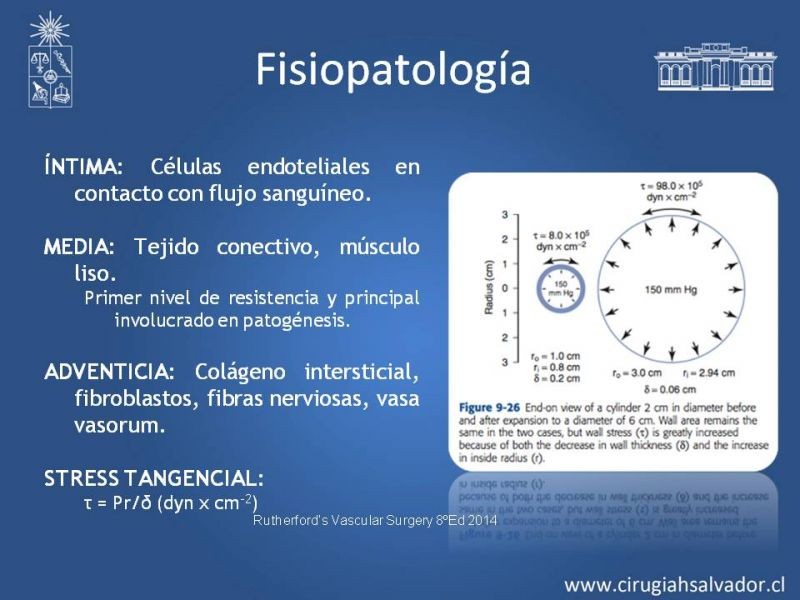 Diapositiva 6 de Aneurismas Periféricos