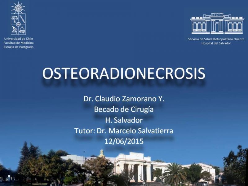 Diapositiva 18 de Osteoradionecrosis