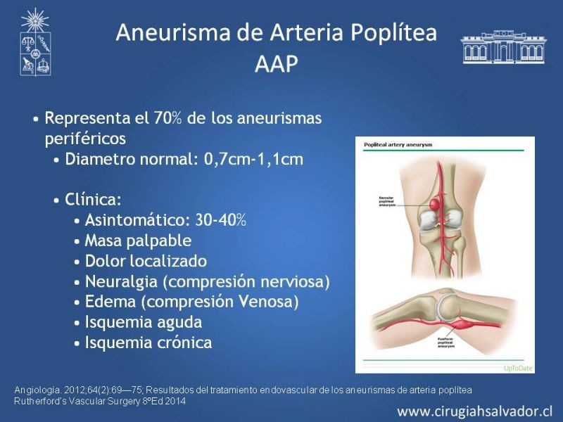 Diapositiva 28 de Aneurismas Periféricos