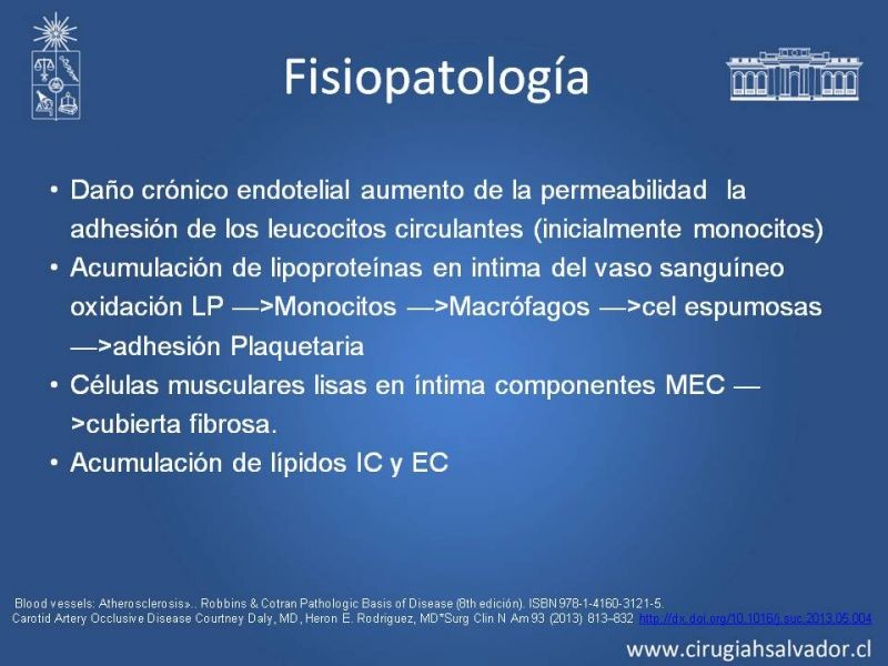 Diapositiva 7 de Estenosis Carotídea Asintomática