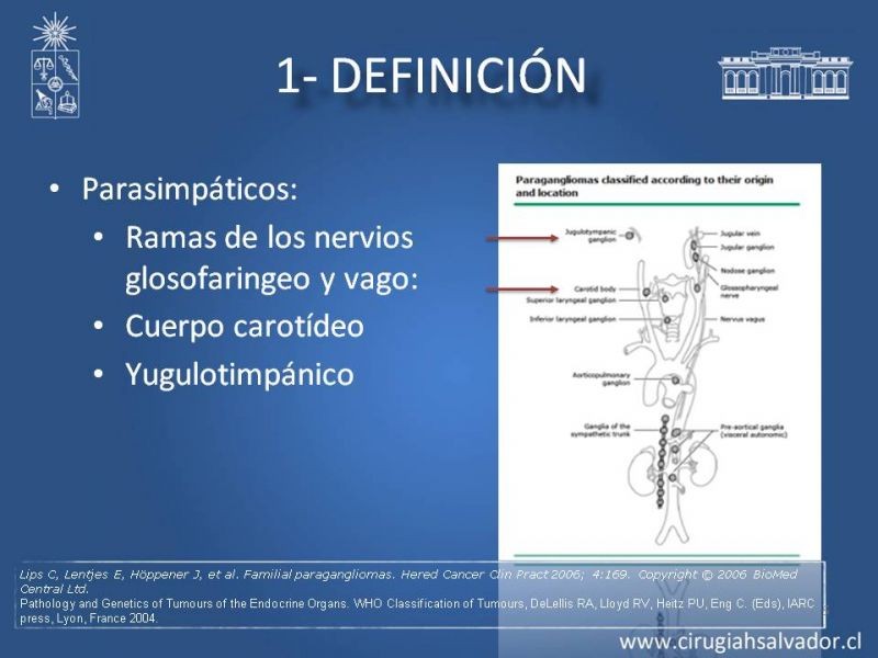 Diapositiva 4 de Paraganglioma cervical