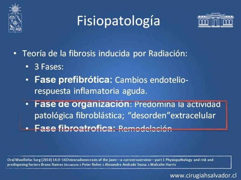 Diapositiva 5 de Osteoradionecrosis