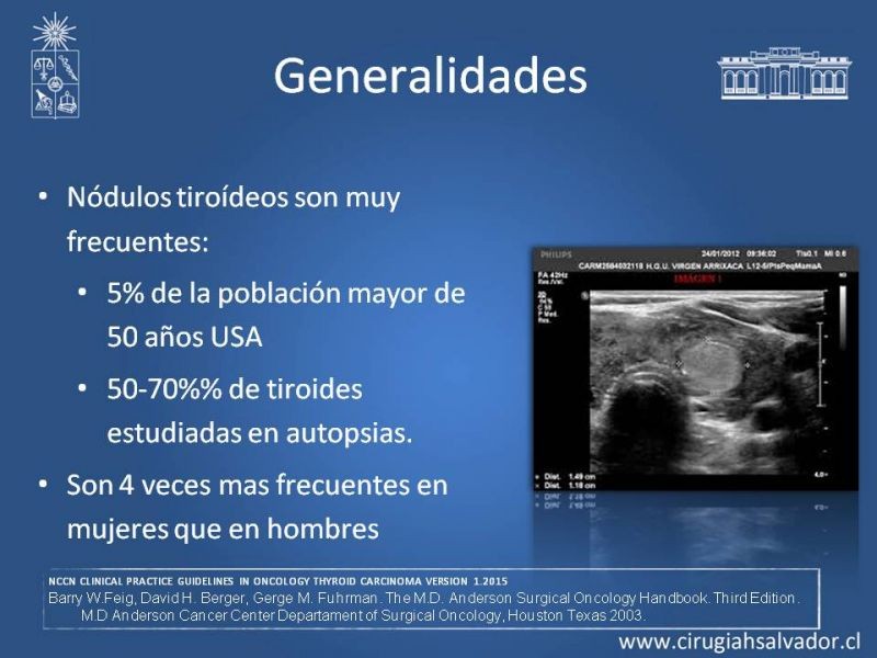 Diapositiva 2 de Cáncer Diferenciado de Tiroides