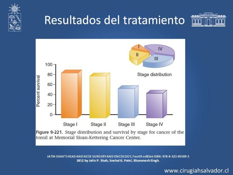 Diapositiva 15 de Cáncer de amígdala (Tonsila palatina)