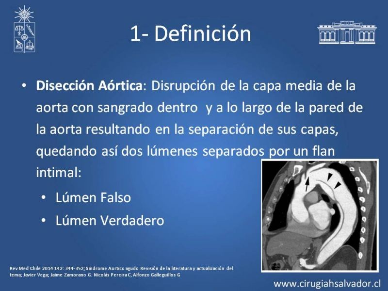 Diapositiva 4 de Síndrome Aórtico Agudo