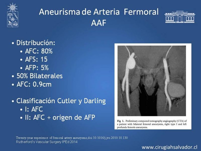 Diapositiva 24 de Aneurismas Periféricos