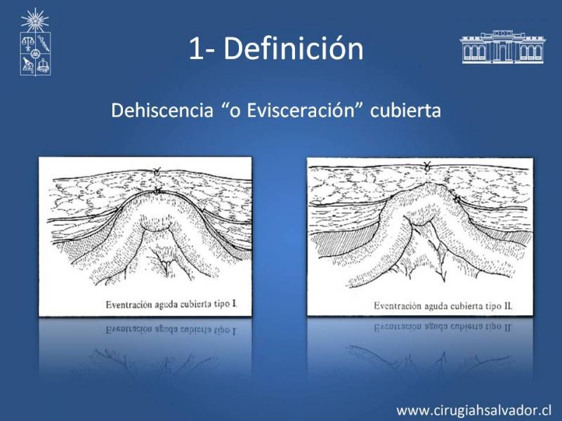 Diapositiva 4 de Manejo de la Evisceración