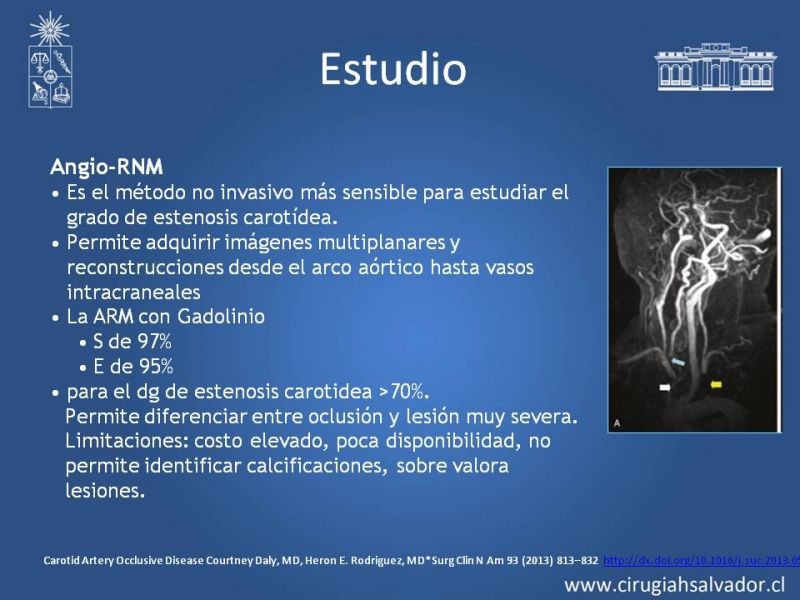 Diapositiva 15 de Estenosis Carotídea Asintomática