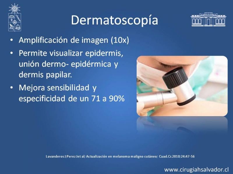 Diapositiva 17 de Manejo Quirúrgico del Melanoma 