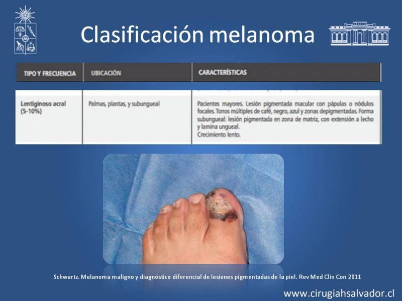 Diapositiva 10 de Manejo Quirúrgico del Melanoma 