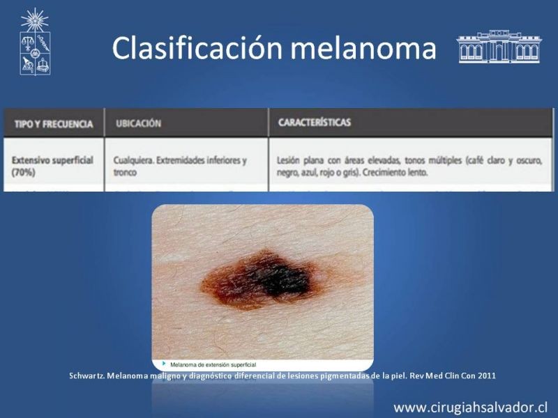 Diapositiva 8 de Manejo Quirúrgico del Melanoma 