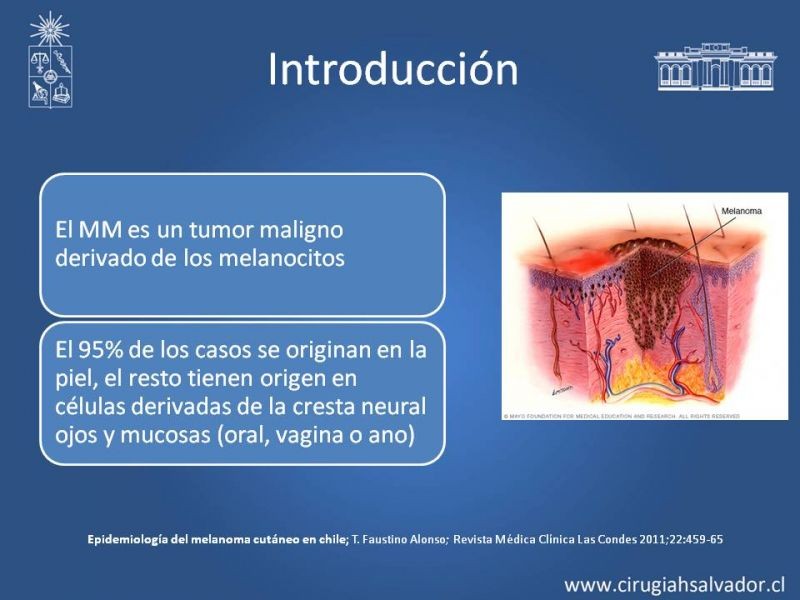 Diapositiva 1 de Manejo Quirúrgico del Melanoma 