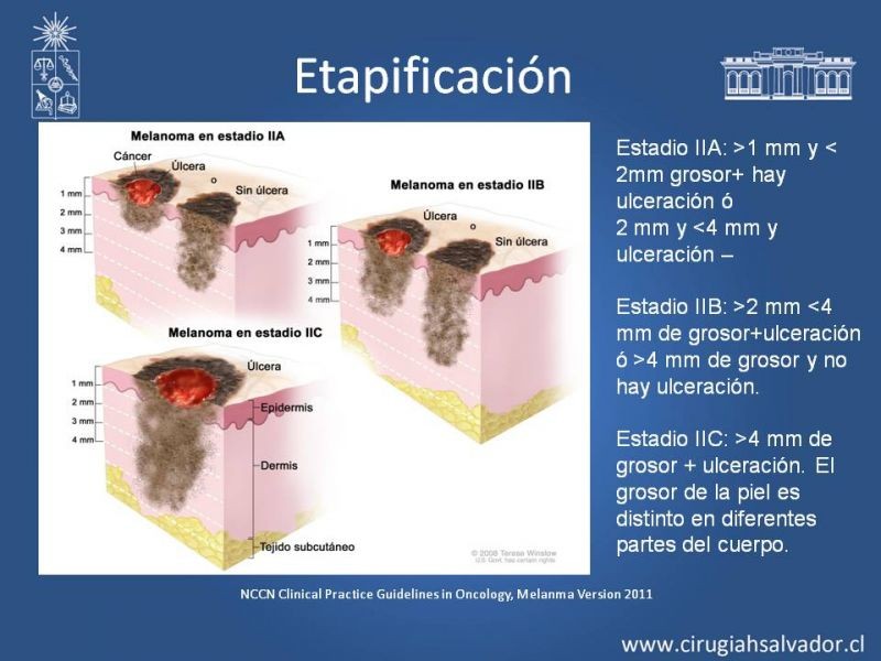 Diapositiva 23 de Manejo Quirúrgico del Melanoma 