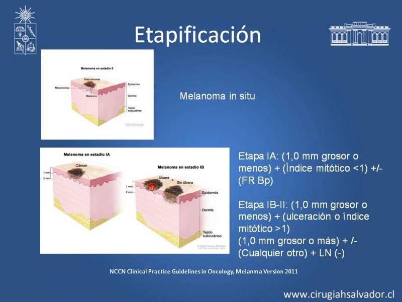 Diapositiva 22 de Manejo Quirúrgico del Melanoma 
