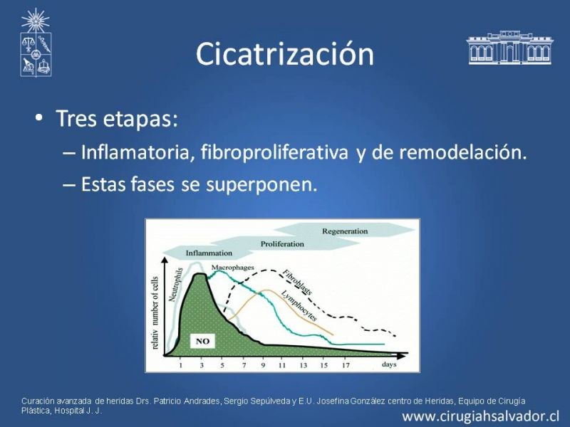 Diapositiva 3 de Curación Avanzada de Heridas