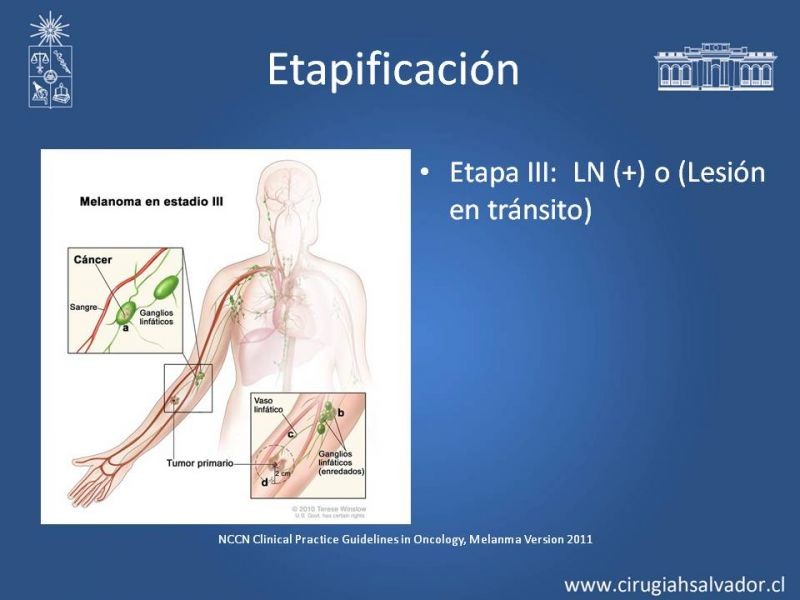 Diapositiva 24 de Manejo Quirúrgico del Melanoma 