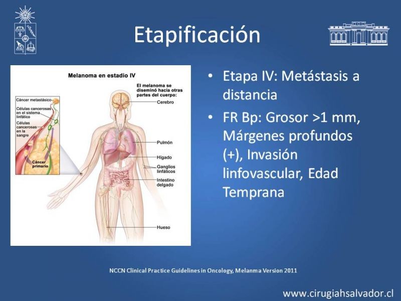Diapositiva 25 de Manejo Quirúrgico del Melanoma 