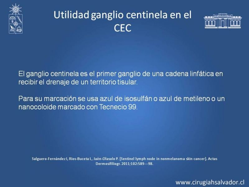 Diapositiva 13 de Ganglio centinela en Cáncer Espinocelular