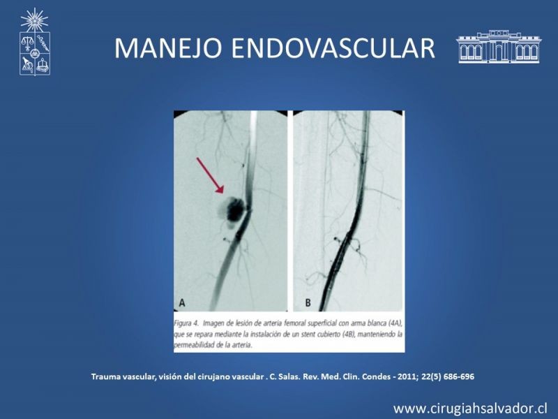 Diapositiva 1 de Trauma extremidades