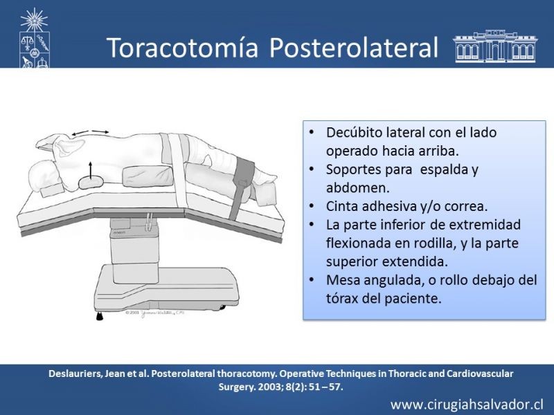 Diapositiva 7 de Accesos quirúrgicos torácicos