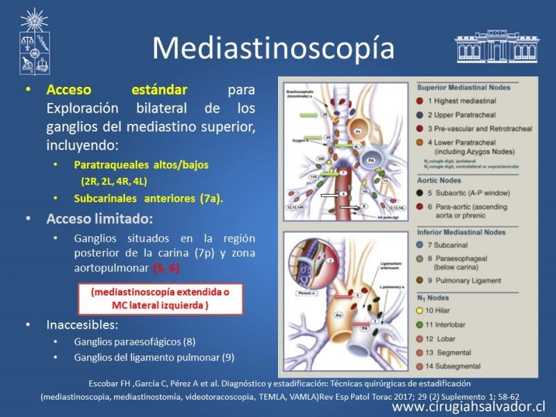 Diapositiva 58 de Accesos quirúrgicos torácicos