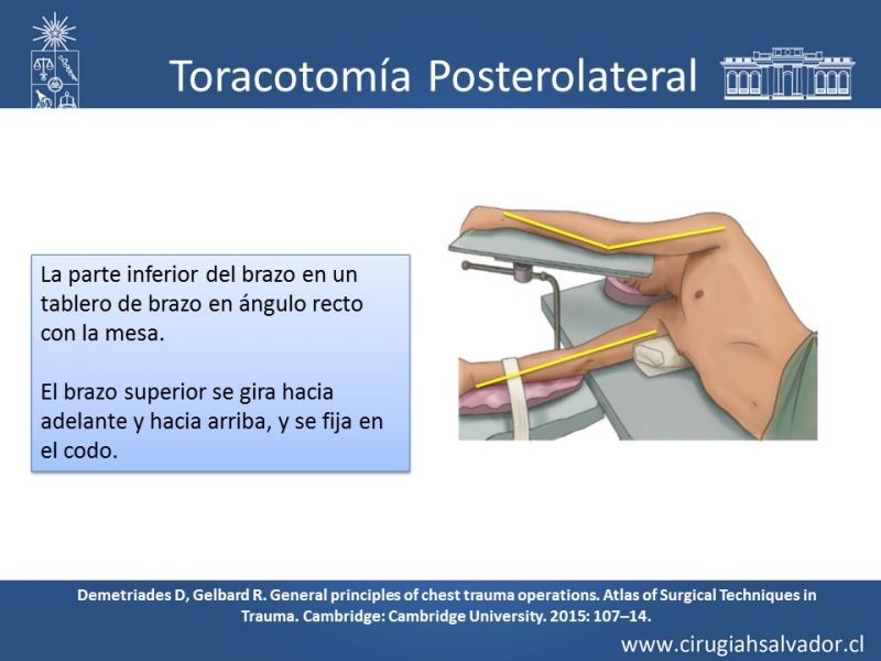 Diapositiva 8 de Accesos quirúrgicos torácicos