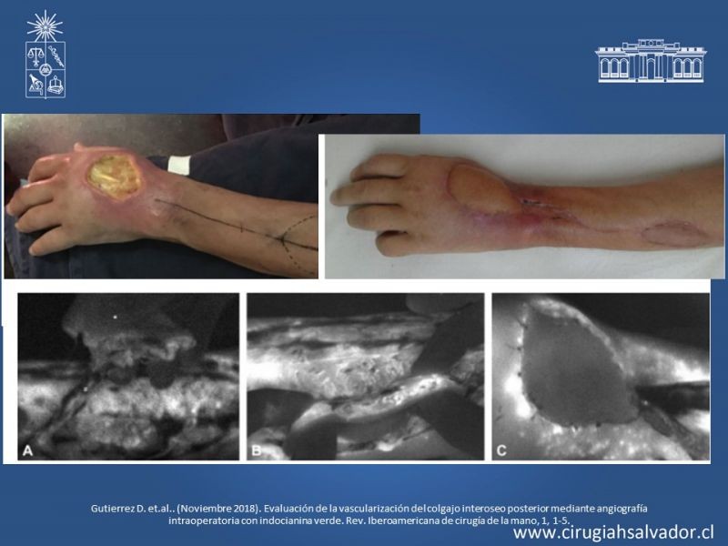 Diapositiva 10 de Monitorización de colgajos