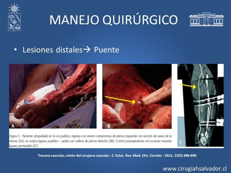Diapositiva 18 de Trauma extremidades