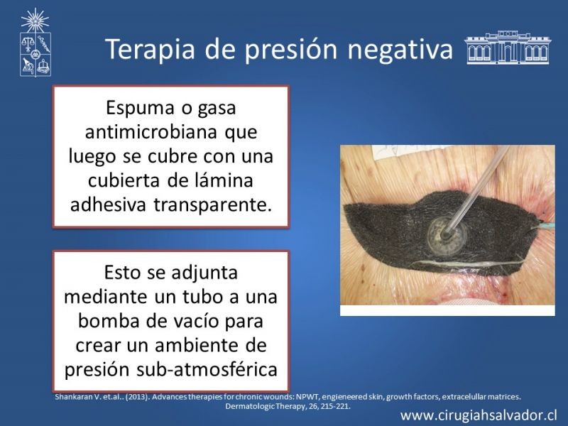 Diapositiva 31 de Curación avanzada de heridas