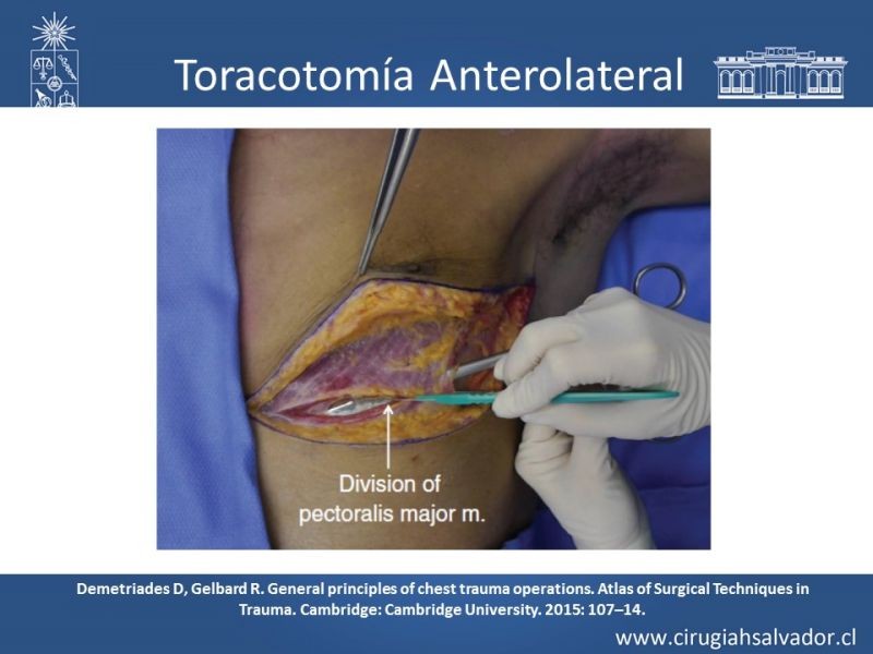 Diapositiva 27 de Accesos quirúrgicos torácicos