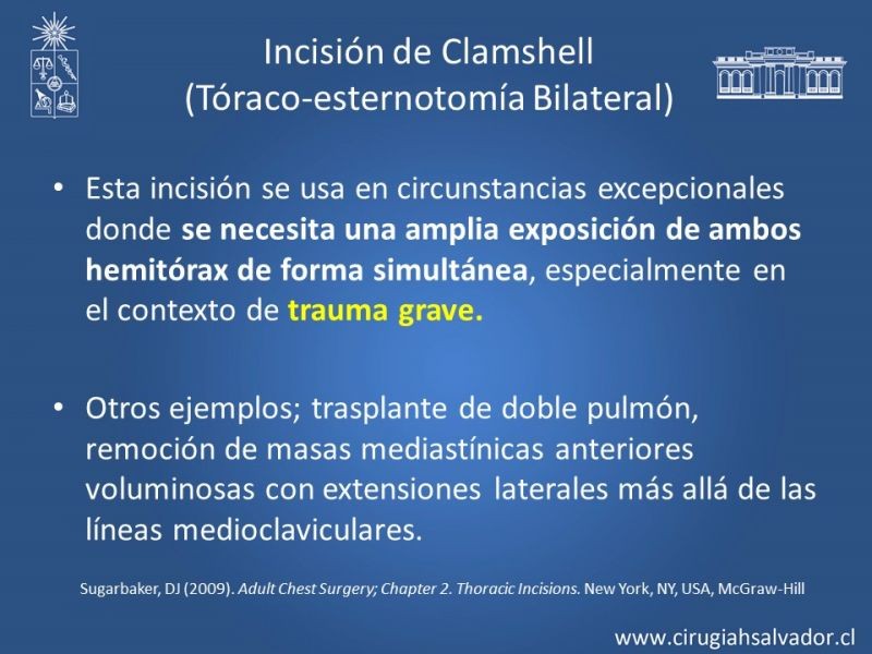 Diapositiva 34 de Accesos quirúrgicos torácicos